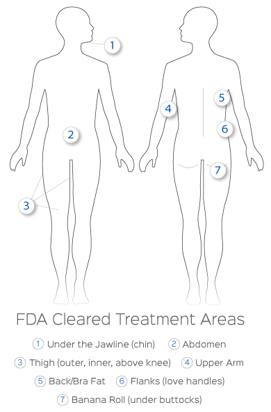 FDA-cleared treatment areas for CoolSculpting Elite including abdomen, flanks, thighs, arms, and chin.