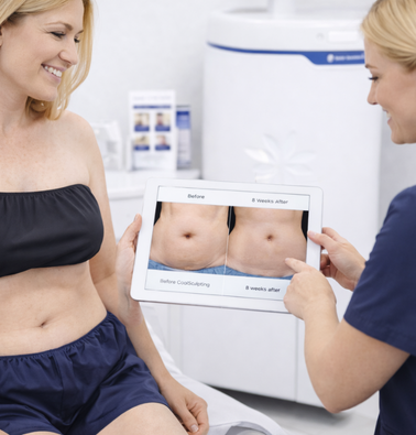 Provider reviewing CoolSculpting Elite before and after abdomen results with patient.