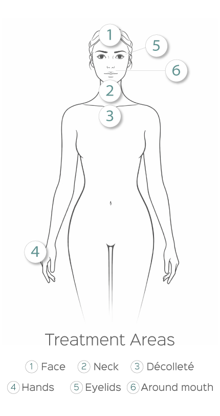 Illustration showing common CO2 laser treatment areas including face, neck, décolleté, eyelids, and hands.