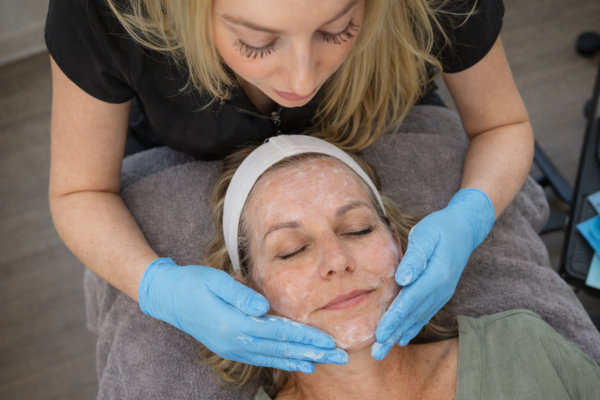Chemical peel treatment in progress with esthetician applying solution to patient’s face in a spa setting