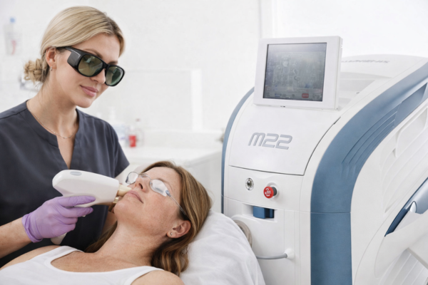 IPL photofacial treatment performed using the M22 device to improve sun damage and redness.