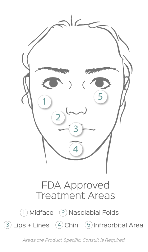Restylane infographic for hyaluronic acid filler injection