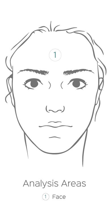 VISIA facial analysis diagram showing mapped areas of the face used for skin evaluation