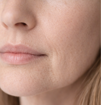 Close-up of lower face showing dull skin texture and reduced radiance.