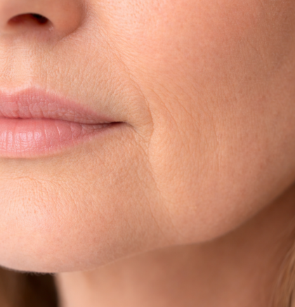 Close-up of lower face and jawline showing mild jowl formation along the jaw.