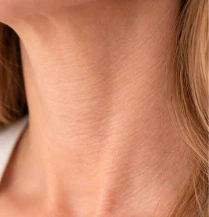 Close-up of neck showing horizontal neck lines.
